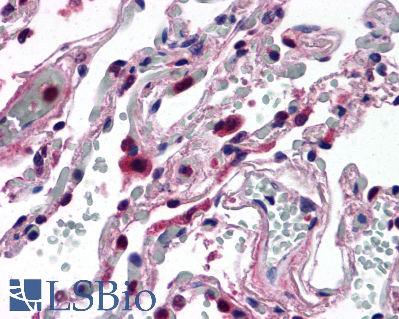 IHC-plus™ Polyclonal Rabbit anti-Human HELO1 / ELOVL5 Antibody (C-Terminus)