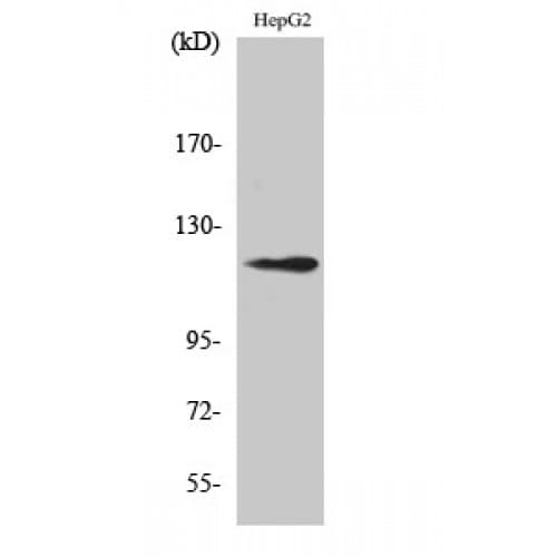 SUPT16H / FACTP140 Antibody (910-990 aa, C-terminal)