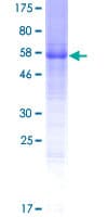 Human LRTM1 Protein (Recombinant GST)