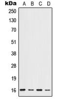 IHC-plus™ ID / ID1 Antibody (Internal)
