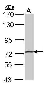 Polyclonal Rabbit anti-Human HHIP / HIP Antibody (aa263-554, IHC, WB)