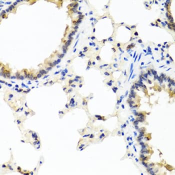 IFNL1 / IL29 Antibody