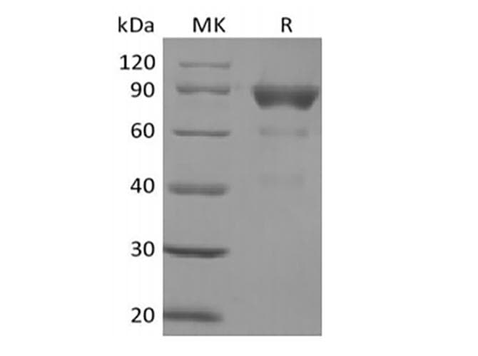 Human SIRPG Protein (Recombinant Fc, C-terminus)