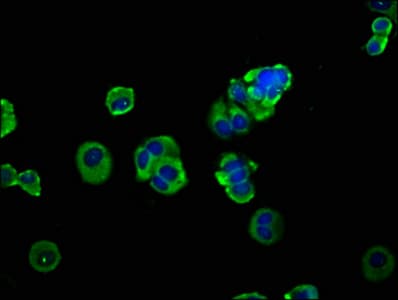 Polyclonal Rabbit anti-Human ADAM8 Antibody (IHC, IF, WB)
