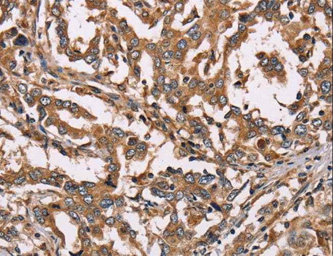 Polyclonal Rabbit anti-Human HSD17B12 Antibody (IHC, WB)