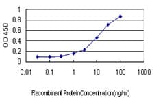IHC-plus™ Neuroserpin Antibody (clone 1D10)