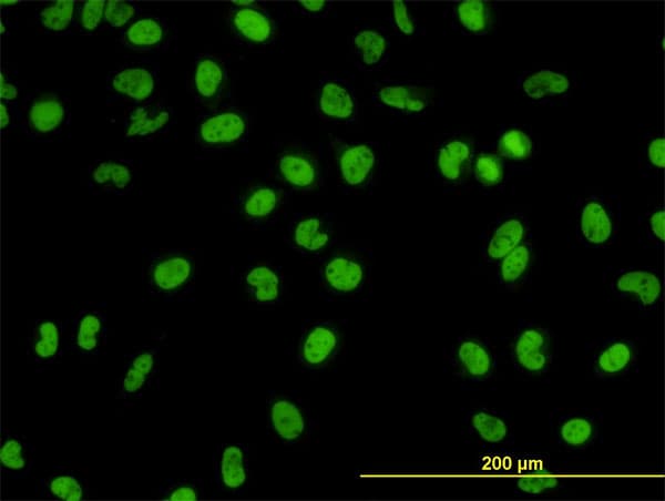 Monoclonal Mouse anti-Human GATA2 Antibody (clone 2D11, IF, WB)