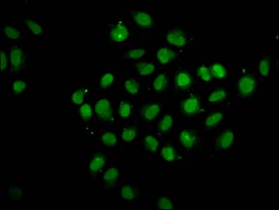 PTPN14 / PEZ Antibody