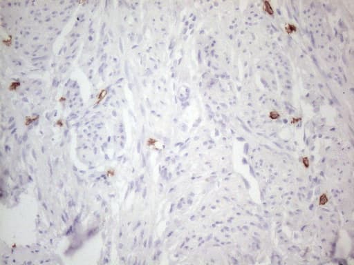 c-Kit / CD117 Antibody (aa27-308, clone OTI2B12, Carrier-free)
