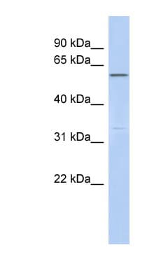 CEP57L1 Antibody (aa359-408)