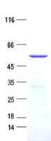 Human LMNTD1 / IFLTD1 Protein (Recombinant His, N-Terminal)