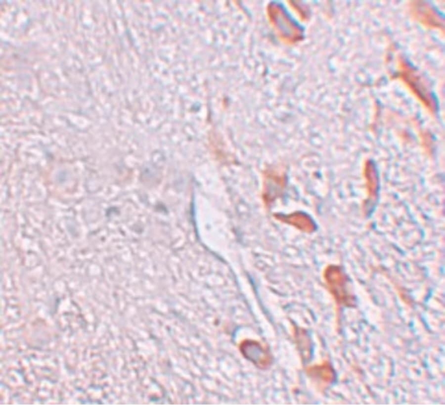 LRRTM1 Antibody