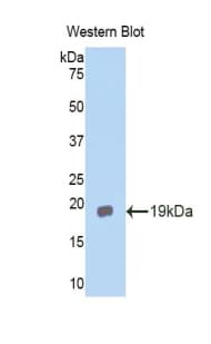 IL11RA Antibody (aa194-329)