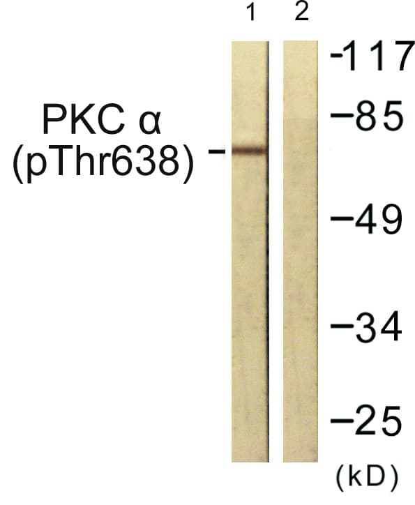 PRKCA / PKC-Alpha Antibody (phospho-Thr638)