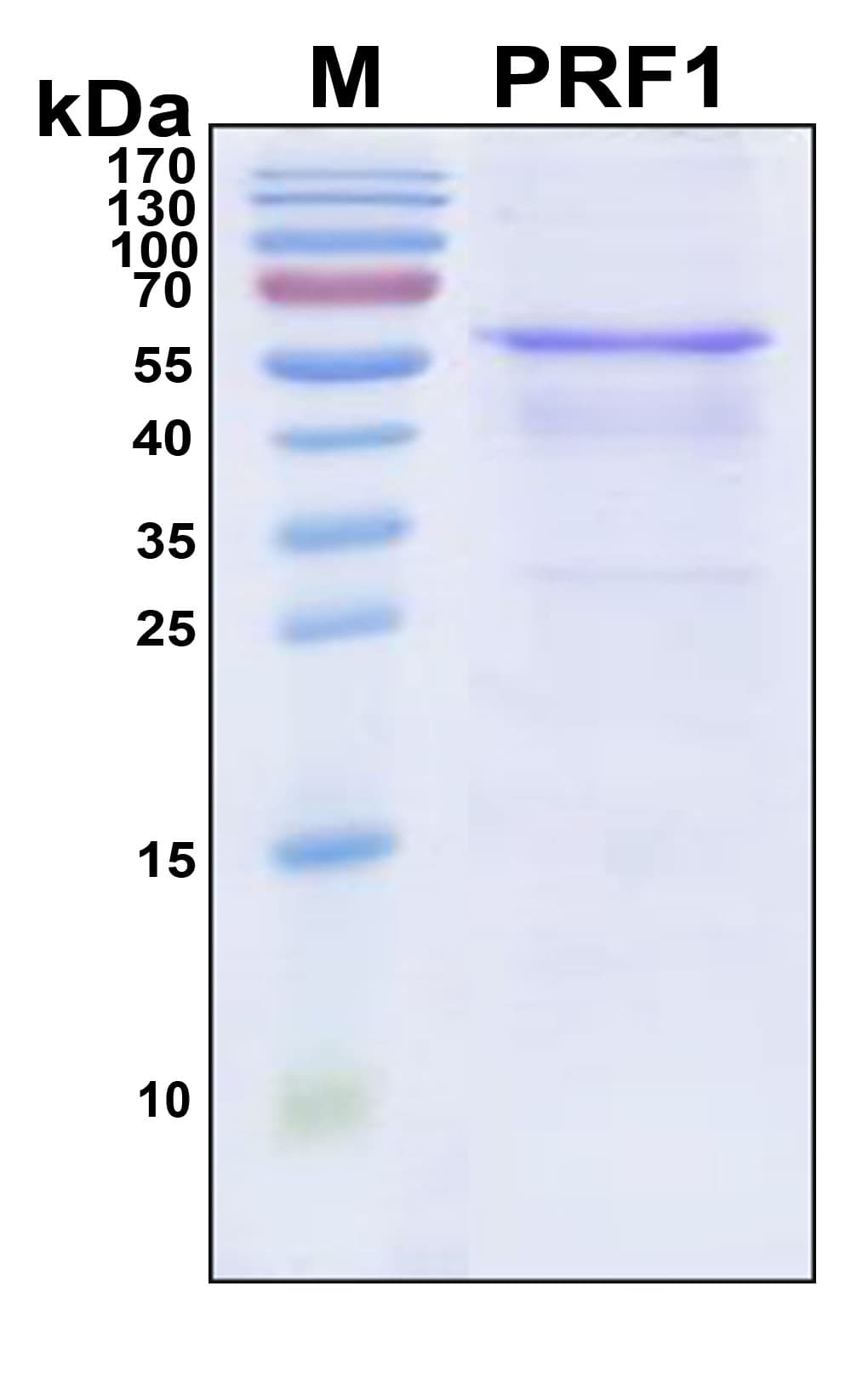 Human PRF1 / Perforin Protein (Recombinant 6His, N-terminus)