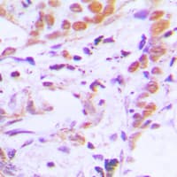 Polyclonal Rabbit anti-Human TCF7 Antibody (N-Terminus, IHC, WB)