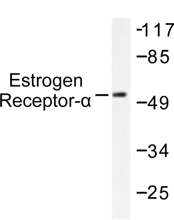 Polyclonal Rabbit anti-Human ER Alpha / Estrogen Receptor Antibody (Leu100, IHC, WB)
