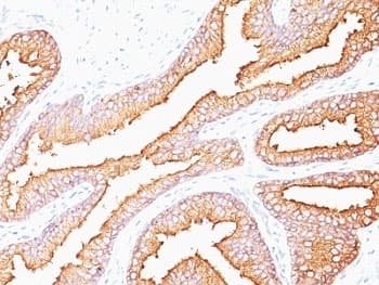 KLK3 / PSA Antibody (clone SPM352)