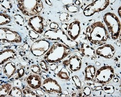 Monoclonal Mouse anti-Human HMRF1L / MTRF1L Antibody (clone OTI1H7, IHC, IF, WB)