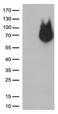 Monoclonal Mouse anti-Human RCOR1 / COREST Antibody (clone OTI9F6, aa256-485, IHC, WB)