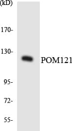 IHC-plus™ Polyclonal Rabbit anti-Human POM121 Antibody (aa1200-1249, IHC, WB)