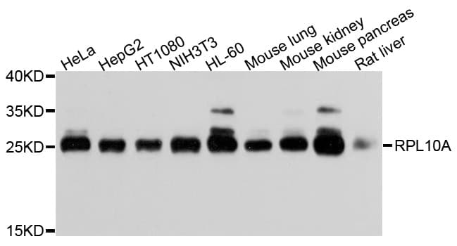 Polyclonal Rabbit anti-Human RPL10A Antibody (WB)