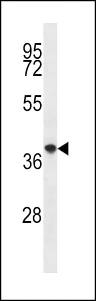 Polyclonal Rabbit anti-Human PQLC2 Antibody (aa222-251, IHC, WB)