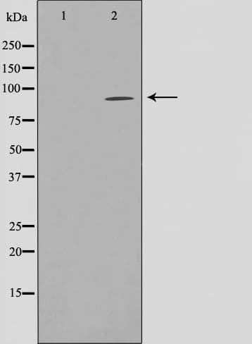 FASTKD1 Antibody