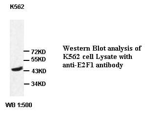 Polyclonal Rabbit anti-Human E2F1 Antibody (IHC, WB)
