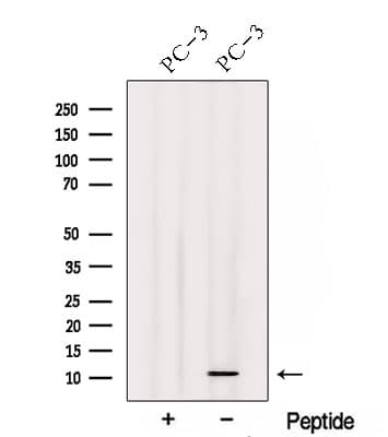 Polyclonal Rabbit anti-Human TIMM13 Antibody (WB)