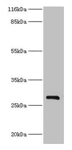 HSD17B14 Antibody (aa1-270)