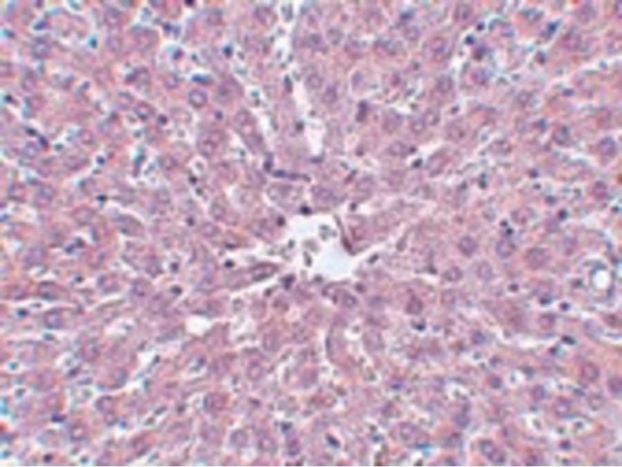 Monoclonal Mouse anti-Human IRAK1 / IRAK Antibody (clone 8F1A7, IHC, WB)