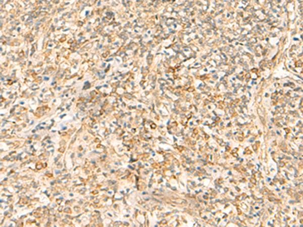 EMC1 Antibody