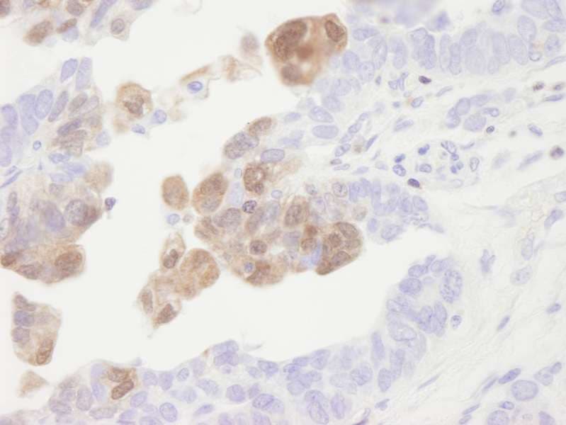 Polyclonal Rabbit anti-Human CAMK4 / CaMK IV Antibody (aa425-C-term, IHC)