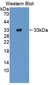 OAS1 Antibody (aa139-358)