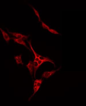 Polyclonal Rabbit anti-Human SLC7A4 Antibody (IF, WB)
