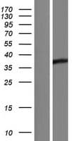 AKR1D1 Protein (Over-Expression Lysate Myc-DDK (Flag))