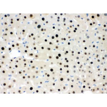 RBBP4 / RBAP48 Antibody (aa395-425)