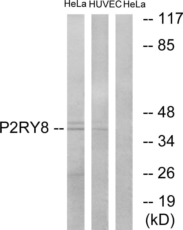 Polyclonal Rabbit anti-Human P2RY8 / P2Y8 Antibody (aa192-241, WB)