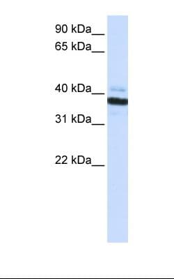 Polyclonal Rabbit anti-Human OAS1 Antibody (C-Terminus, IHC, WB)
