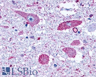 PathPlus™ GRM8 / MGLUR8 Antibody (N-Terminus)
