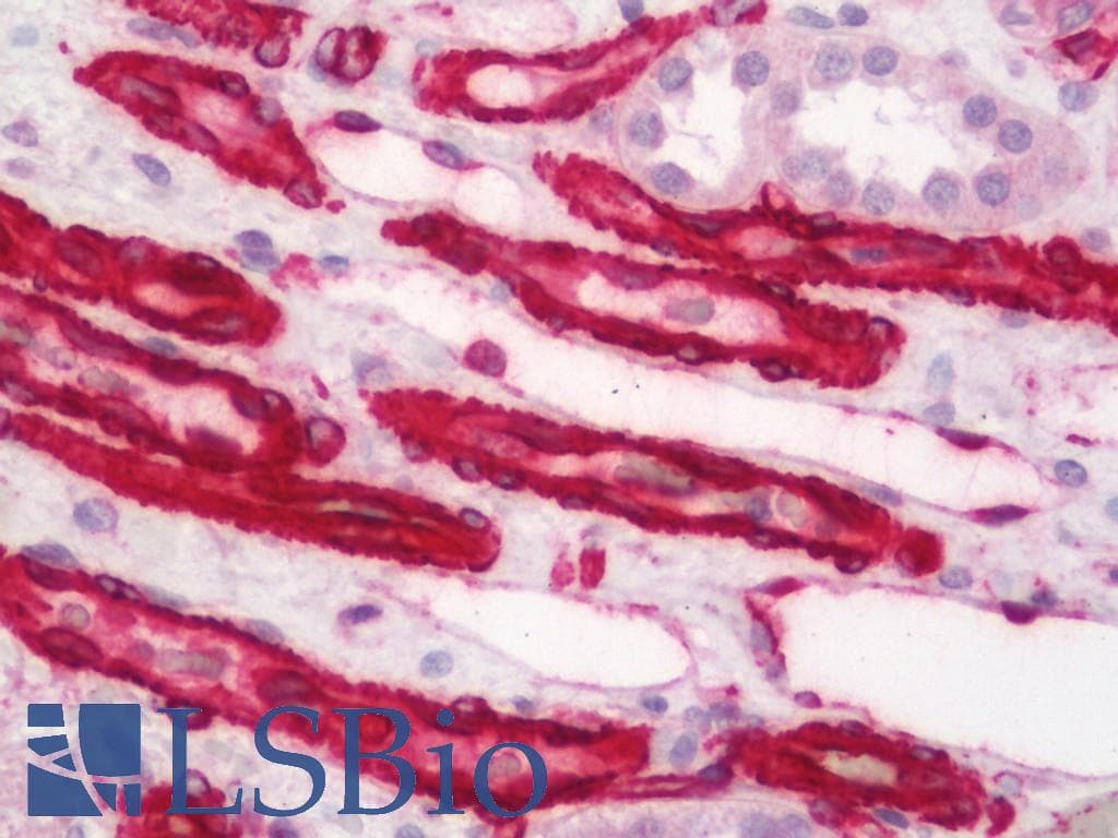 F8 / FVIII / Factor VIII Antibody (aa1669-1824)
