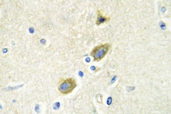 GAS6 Antibody (Gly309)