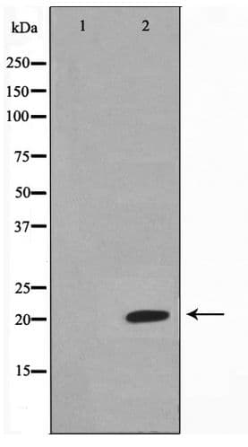 Polyclonal Rabbit anti-Human MSC / Musculin Antibody (IHC, WB)