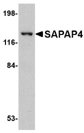 IHC-plus™ Polyclonal Rabbit anti-Human DLGAP4 Antibody (IHC, WB)