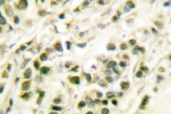 POLB / DNA Polymerase Beta Antibody (Gln324)