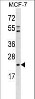 Polyclonal Rabbit anti-Human EBP Antibody (aa201-230, WB)