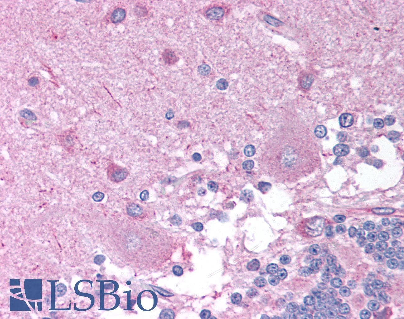 Polyclonal Rabbit anti-Human CHRNB2 Antibody (aa21-70, IHC, WB)