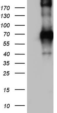 Monoclonal Mouse anti-Human CD68 Antibody (clone OTI6D3, aa22-319, WB)