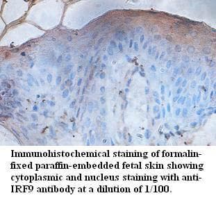 Polyclonal Rabbit anti-Human ISGF3 / IRF9 Antibody (aa239-389, IHC, WB)